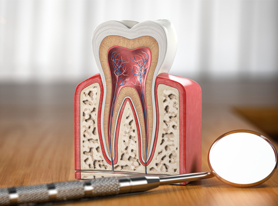 Root Canal Treatment in Castro Valley