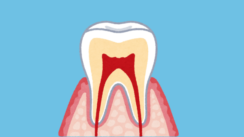 why does tooth pulp need to be removed