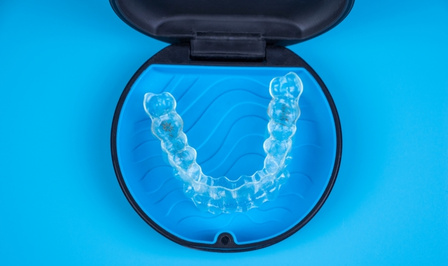 role of lifestyle in your invisalign journey