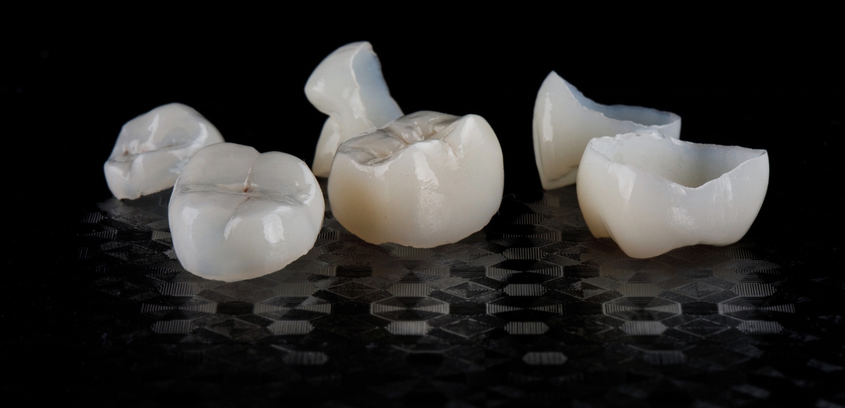 Can Porcelain Crowns Be Used for Front Teeth