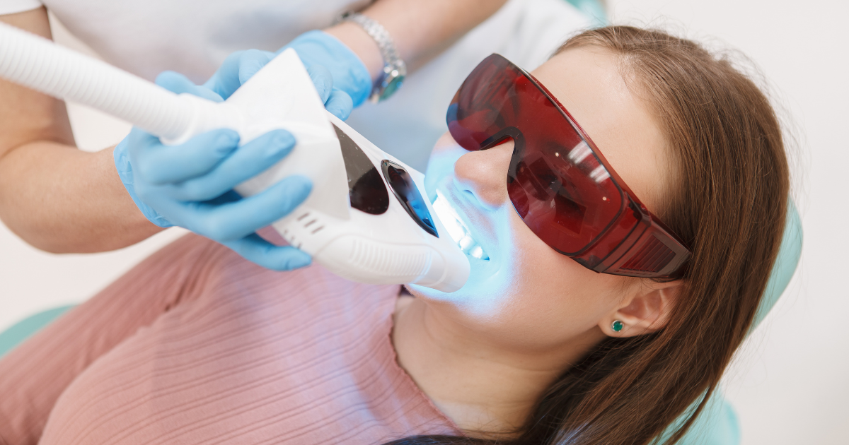 Top 5 Benefits of Professional Teeth Whitening for a Brighter Smile
