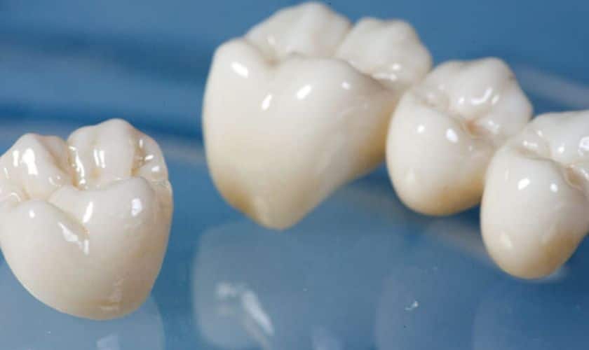 Dental Crowns in Austin, TX