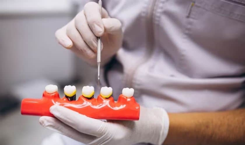Dental Implants in South Austin, TX