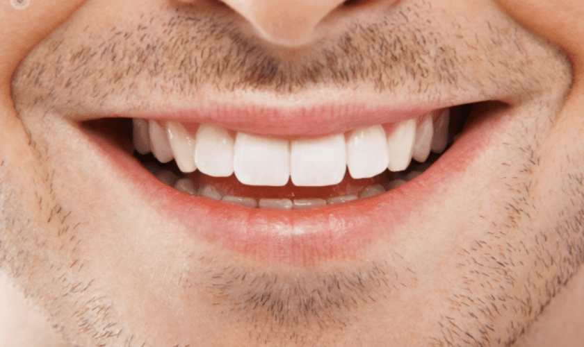 Misconceptions About Cosmetic Dentistry