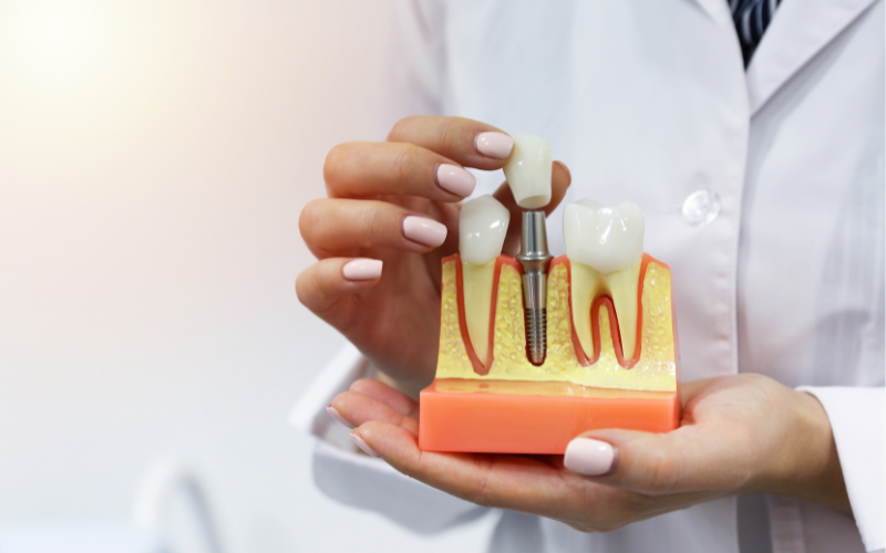 smile with confidence again with dental implants