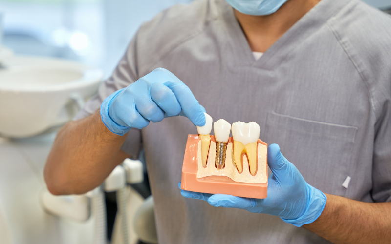 unveiling the comfort options for dental implants