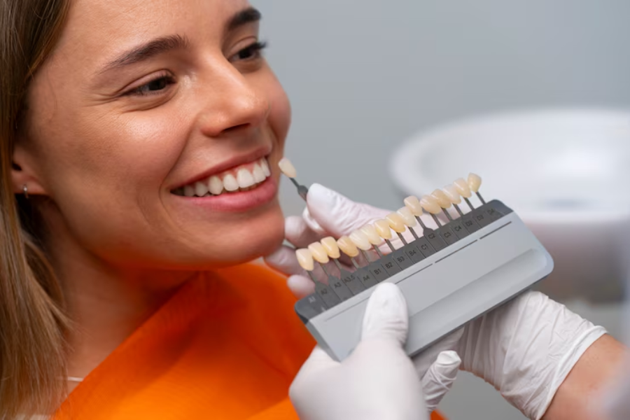 how to care for your dental veneers