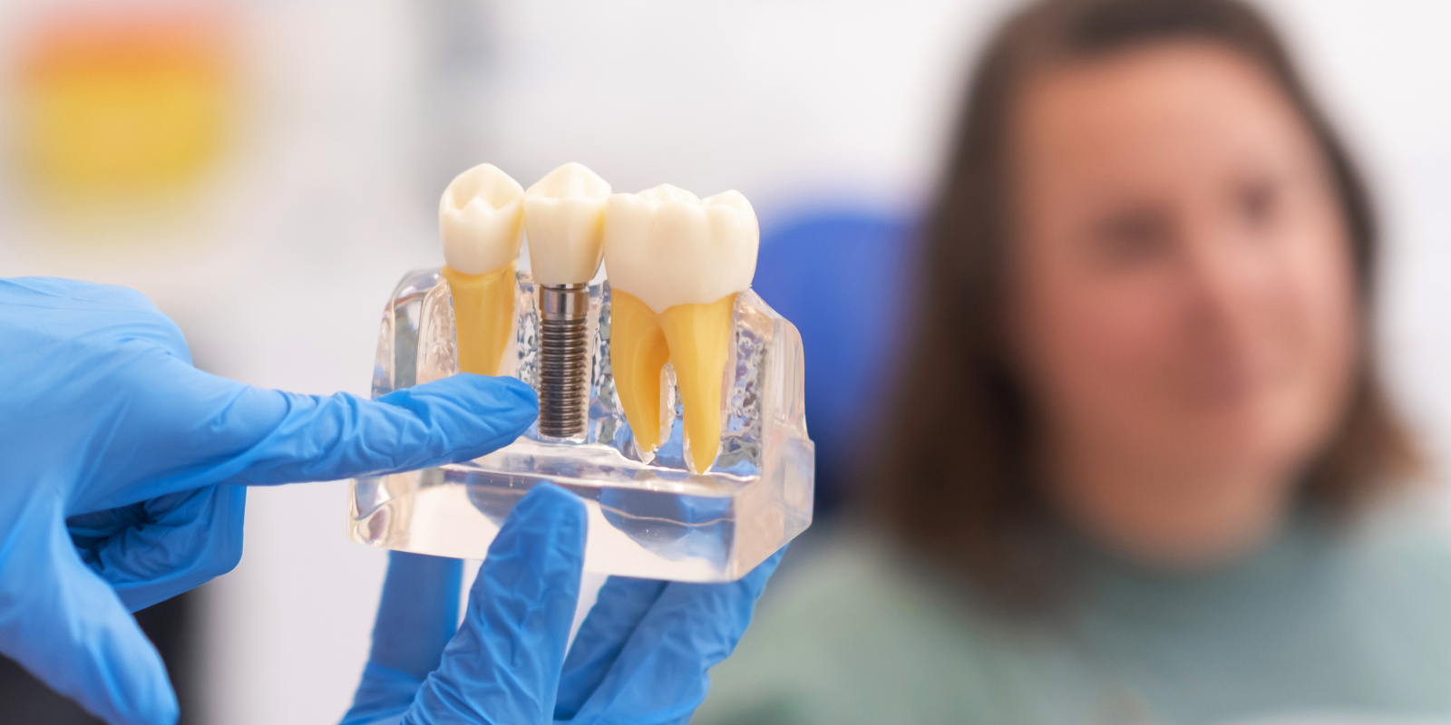 how-to-keep-your-dental-implants-healthy-and-durable
