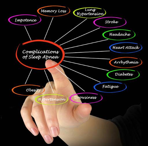 obstructive sleep apnea