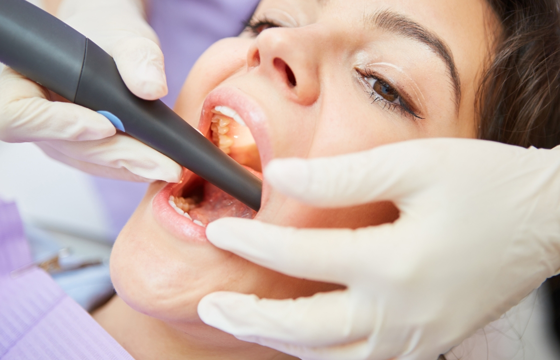 The Benefits of Laser-Assisted Root Canals