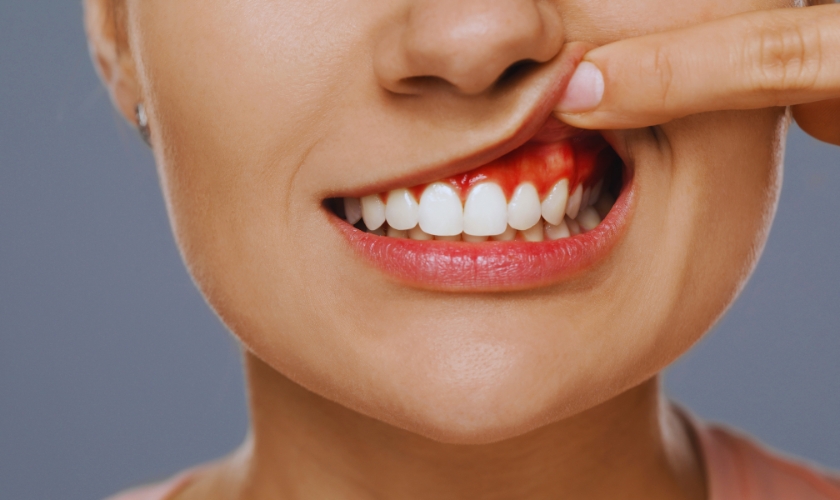 when is a tooth abscess a dental emergency
