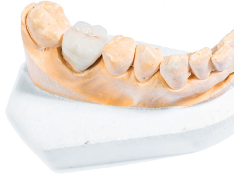 Temporary Crown Post-Op Instructions