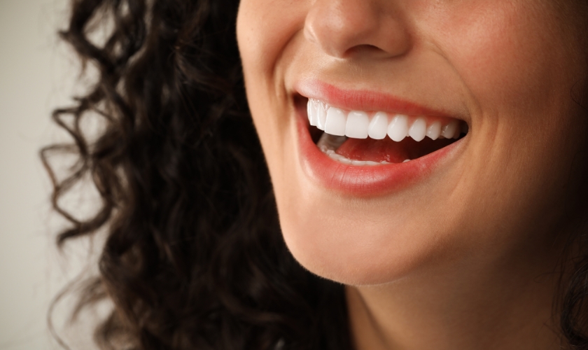 Are Veneers the Secret to a Perfect Hollywood Smile