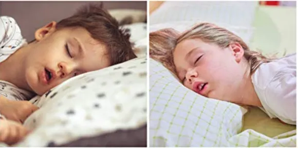 Featured image for “SLEEP DISORDERED BREATHING IN KIDS (SDB)”