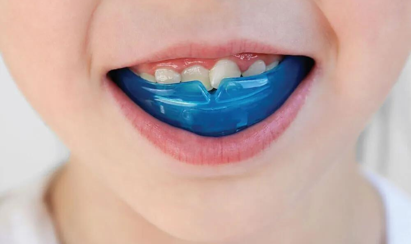 Myobrace Suitability and Process for Kids and Teens