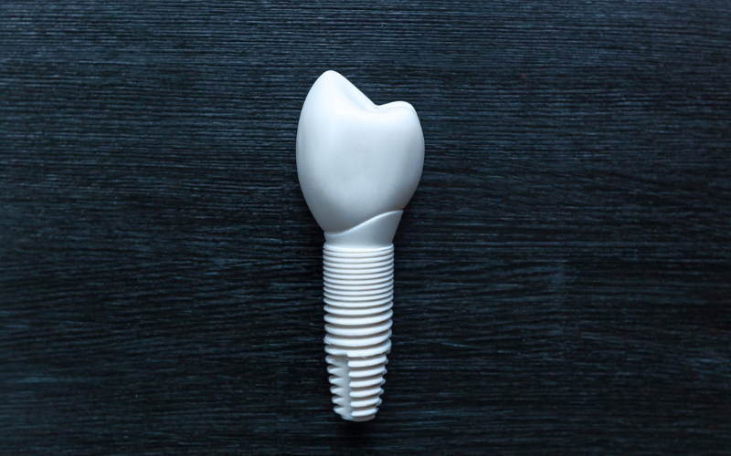 Featured image for “The Oral Health Benefits Of Zirconia Implants Over Metal Ones”