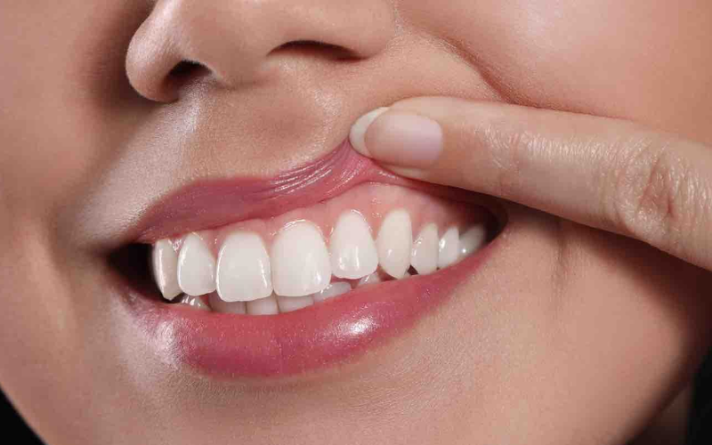 Featured image for “How Can I Rebuild My Gums Naturally?”