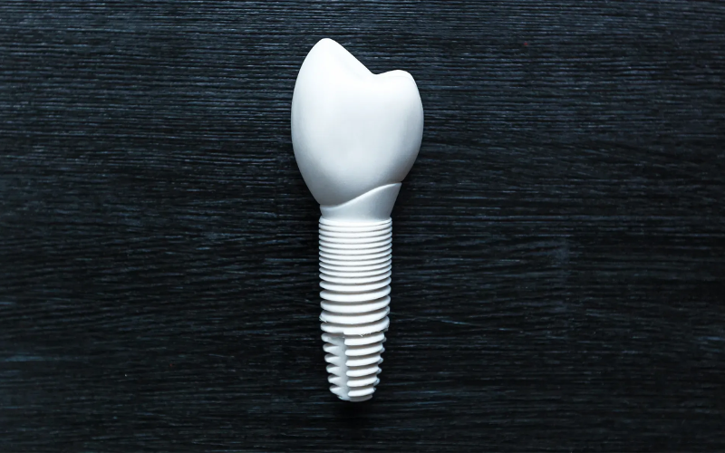 Featured image for “How Ceramic Dental Implants Promote Bone Regeneration: Insights And Benefits”