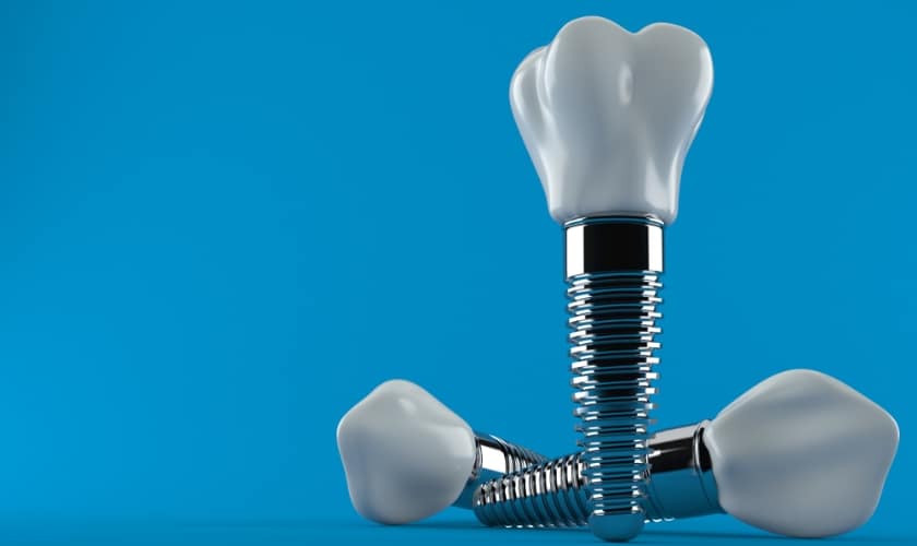 Dental implant failure prevention