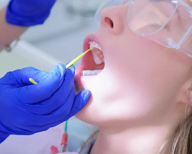 fluoride treatment matthews nc