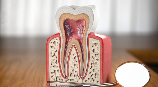 root canal therapy matthews nc