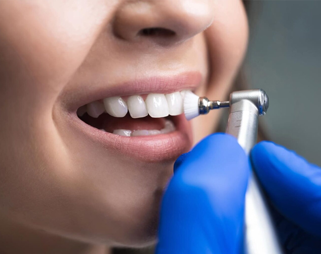 teeth cleaning matthews nc