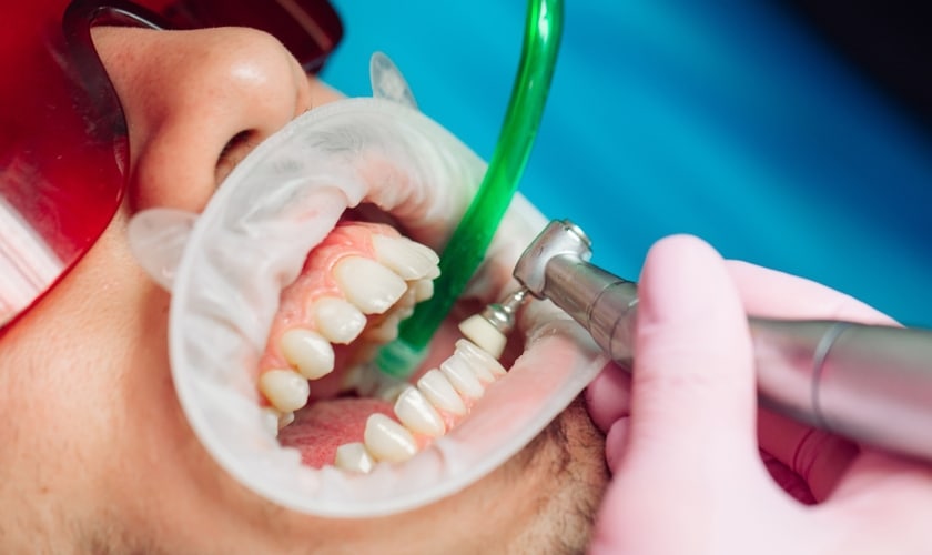 Featured image for “Boost Your Dental Health: 10 Foods to Eat Before Your Next Teeth Cleaning”