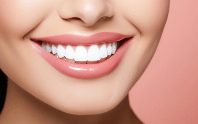 Featured image for “Teeth Whitening For Teens: Is It Safe And Effective?”