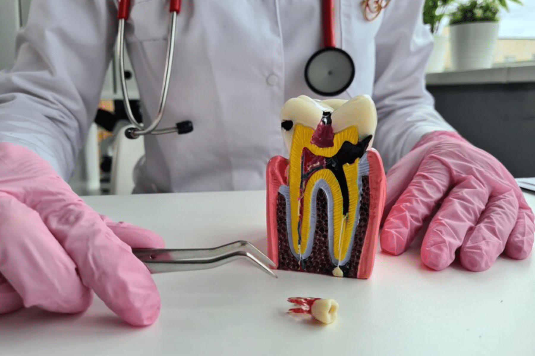 tooth pain increase days after root canal treatment