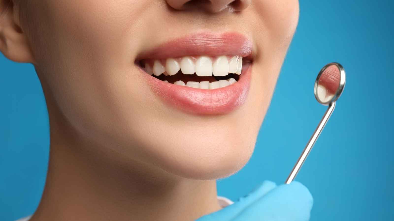 how long do cosmetic dentistry procedures last