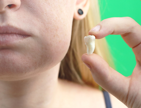 Teeth Extractions in Jamaica Plain - JP Dental