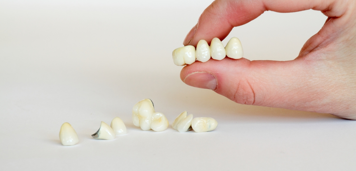 Everything You Need To Know About Dental Bridges