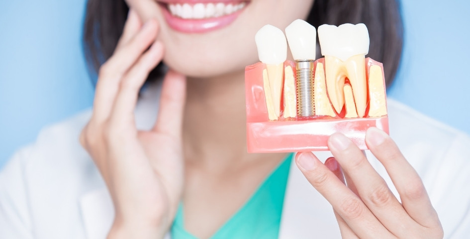 what makes dental implants resistant to cavities and durable