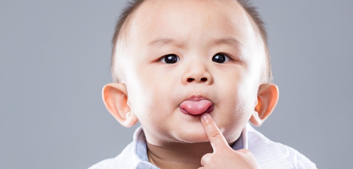 signs of tongue thrust in infants