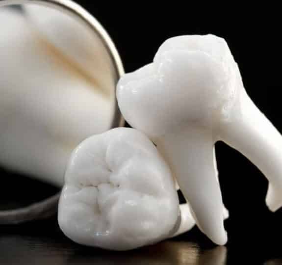 Tooth Extractions Midwest City - Midwest Smiles