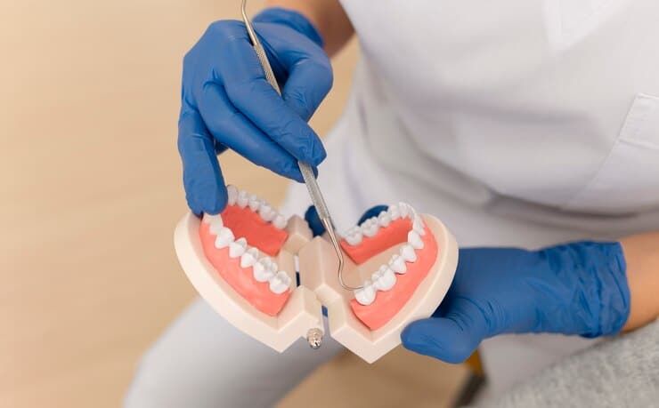 Crown or Bridge? A Cosmetic Dentist Answers