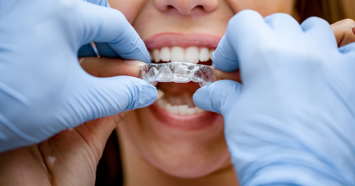 First Visit to an Invisalign Dentist