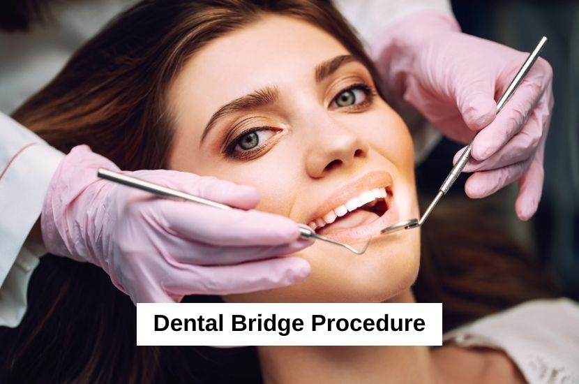 Dental Bridges In Jupiter