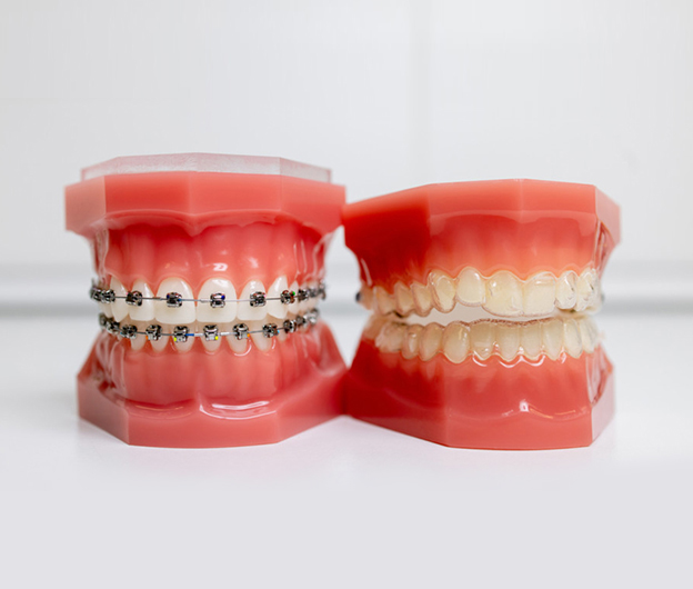 Invisalign In Jupiter FL