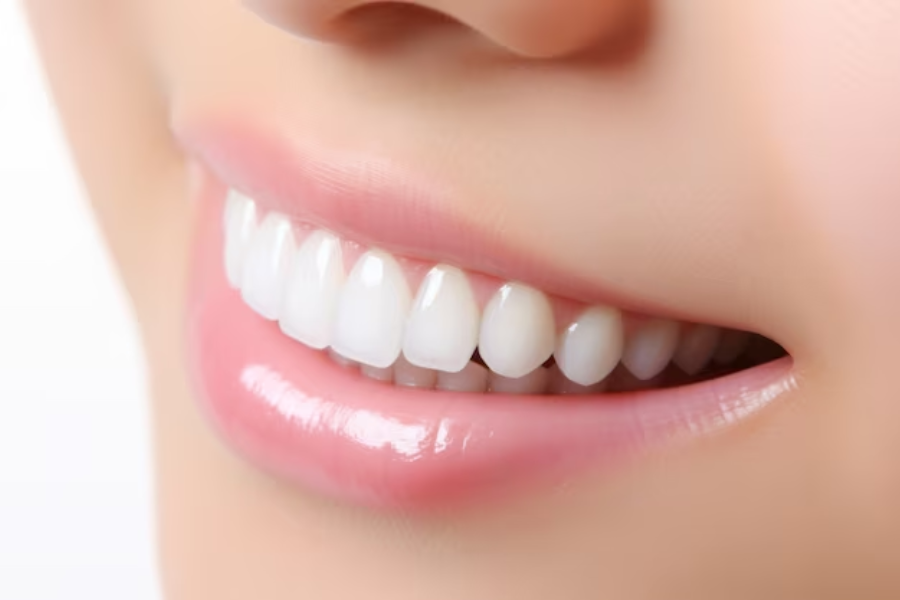 effective teeth-whitening