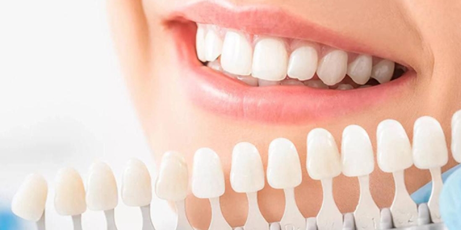 Top Procedures Involved in a Smile Makeover