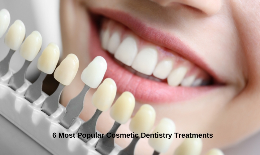 6 Most Popular Cosmetic Dentistry Treatments