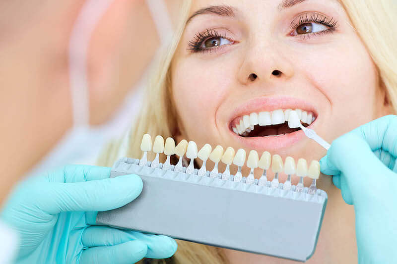 checking teeth color before whitening treatment