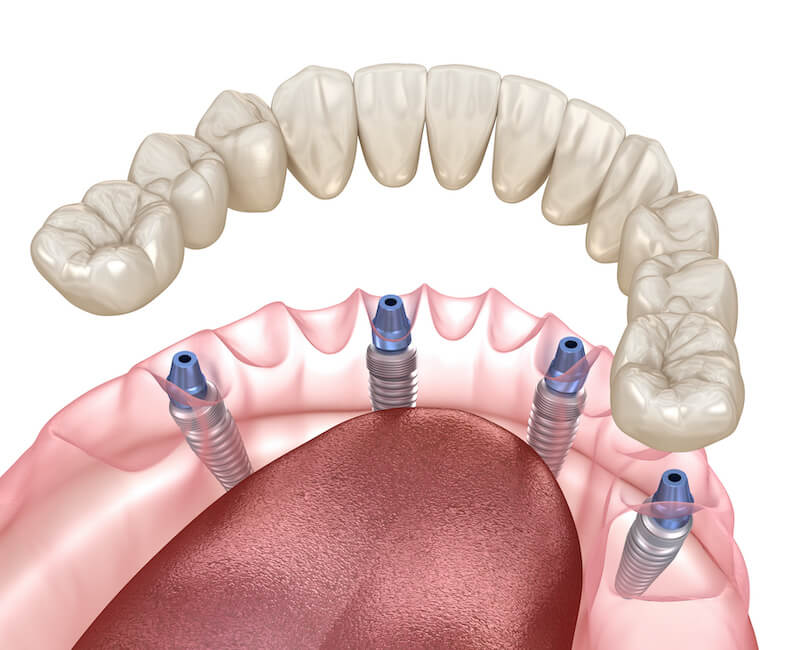 dr. lindsay cash at pearl dental studio