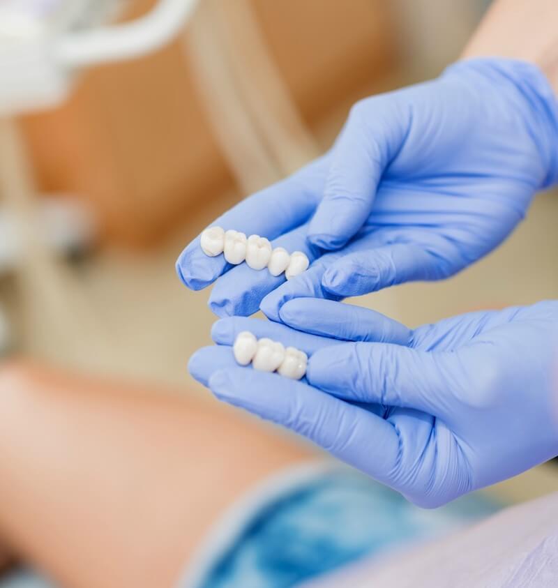 caring for dental crowns