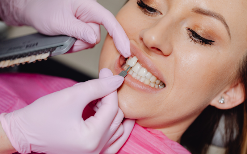 Getting Veneers Before Halloween Parties