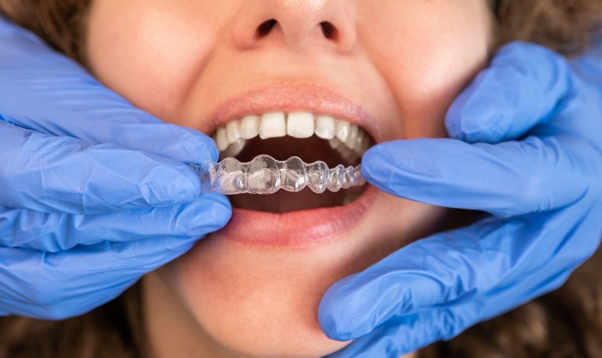 5 lifestyle changes that can maximize your invisalign results