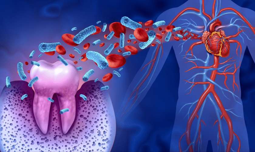 Gum Disease May Increase the Risk of Cardiovascular Disease