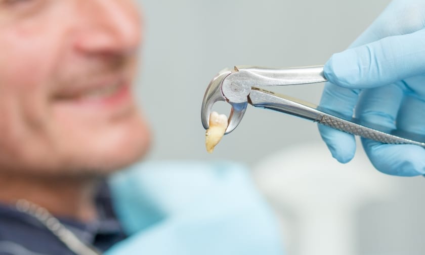 Tooth Extraction Recovery: 7 Essential Tips for a Smooth Healing Process