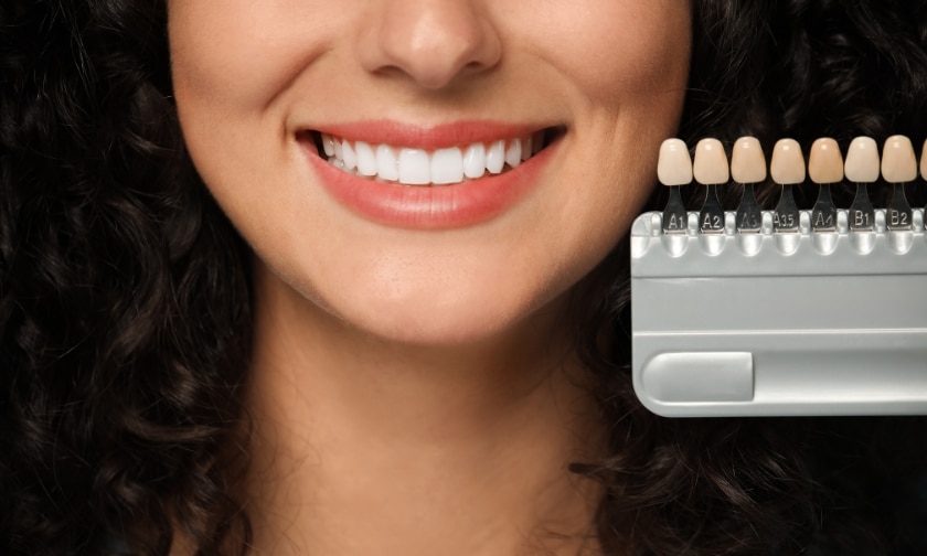 Veneer Myths: Debunking Common Misconceptions About Porcelain Smiles